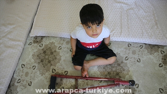 تركيا.. طفل سوري يثبّت قدمه بالحياة بواسطة ساقه الصناعية